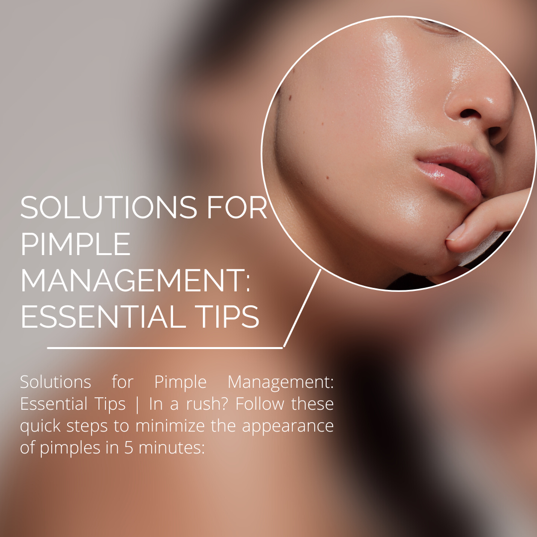 Solutions for Pimple Management: Essential Tips